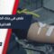 نقص حاد في وحدات الدم بمدينة اللاذقية